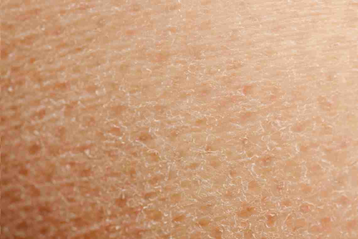 Шелушится кожа на мошонке: возможные причины и методы лечения