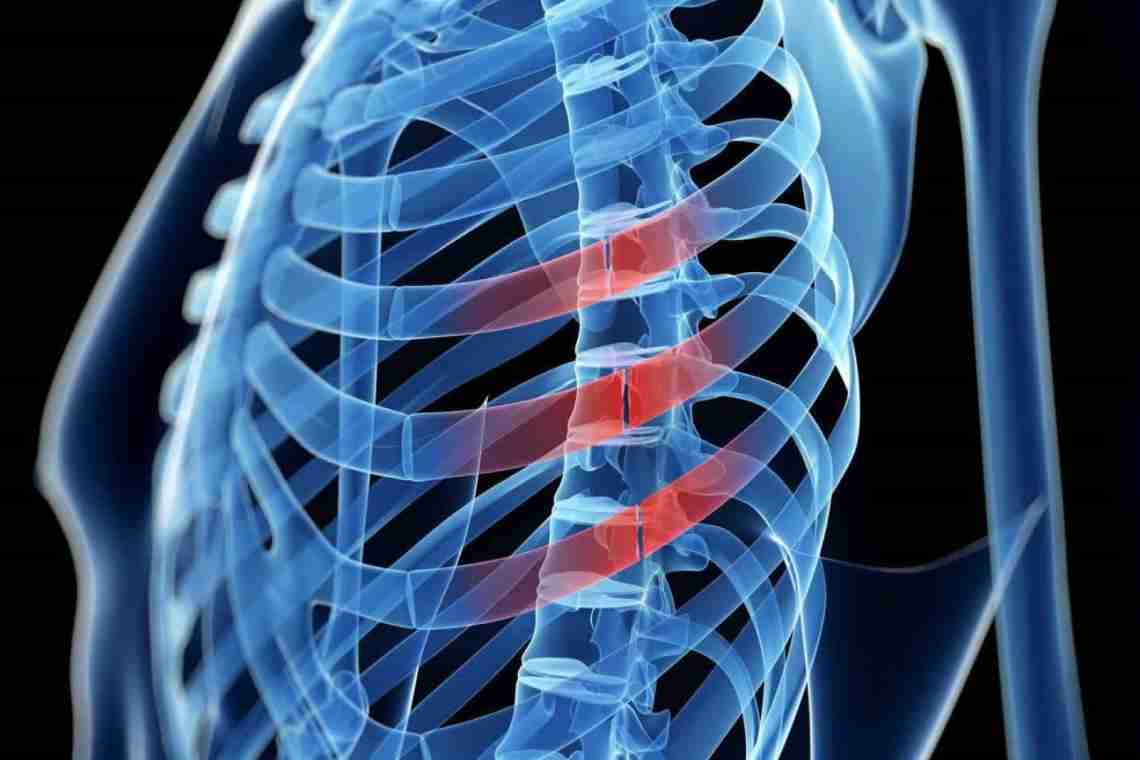 Ушиб грудной клетки: лечение, симптомы, предупреждение