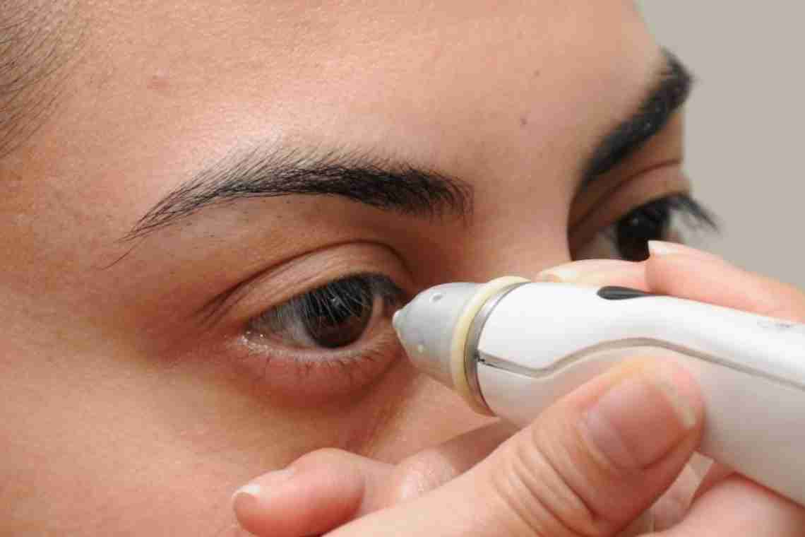 Повышенное глазное давление - лечение или приговор?