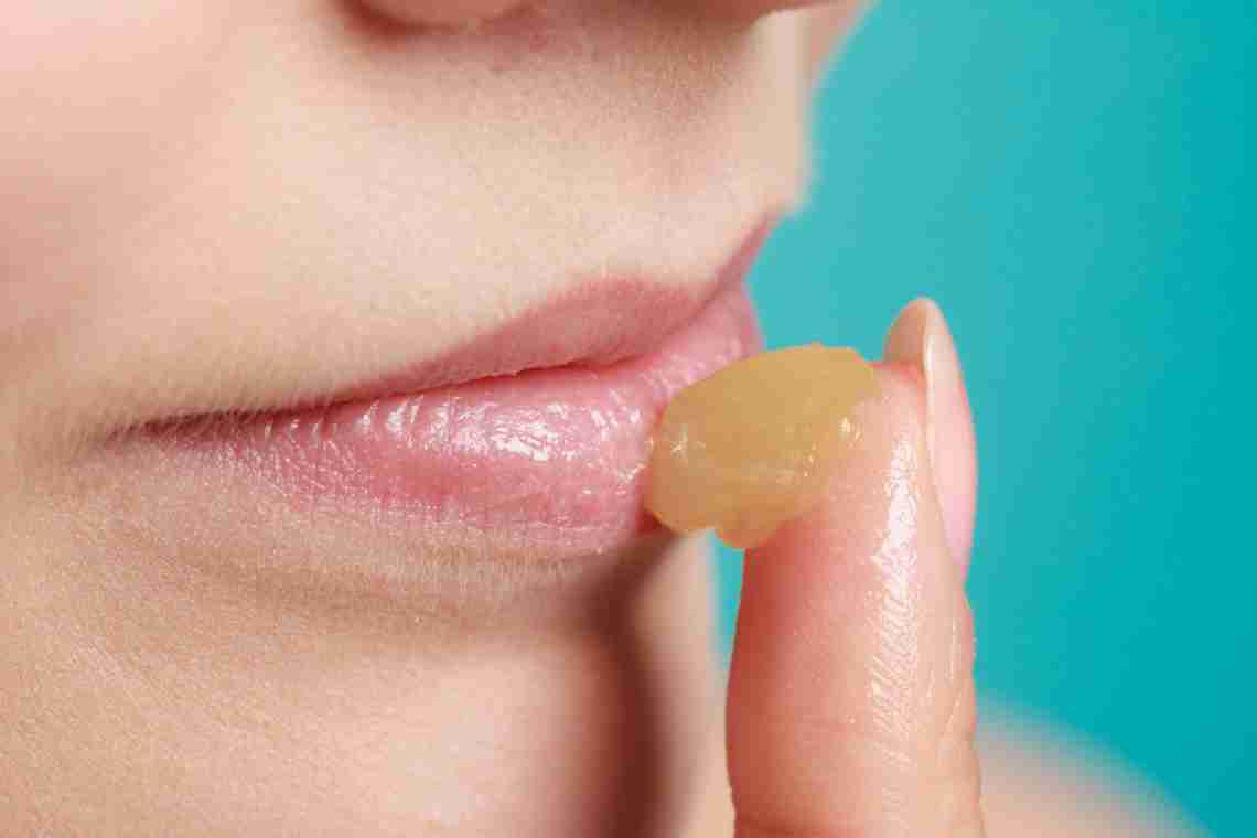 Как вылечить простуду на губе? Несколько дельных советов.
