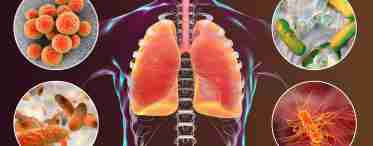 Что такое пневмония и как её лечат?
