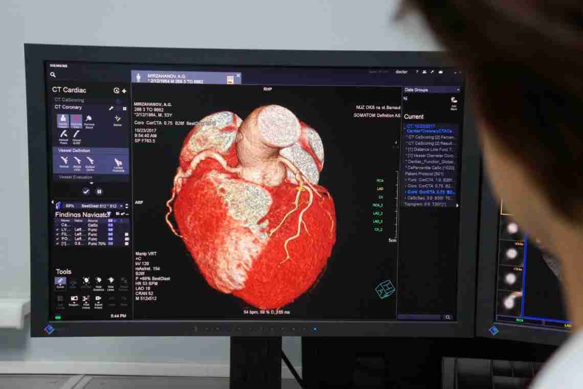 Коронарография: отзывы врачей, общая тенденция применения метода для диагностики сердечных патологий