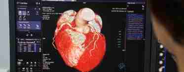 Коронарография: отзывы врачей, общая тенденция применения метода для диагностики сердечных патологий