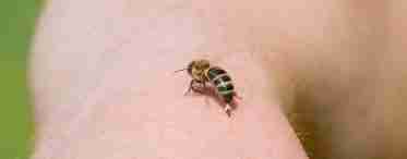 Что делать при укусе пчелы? Первая помощь