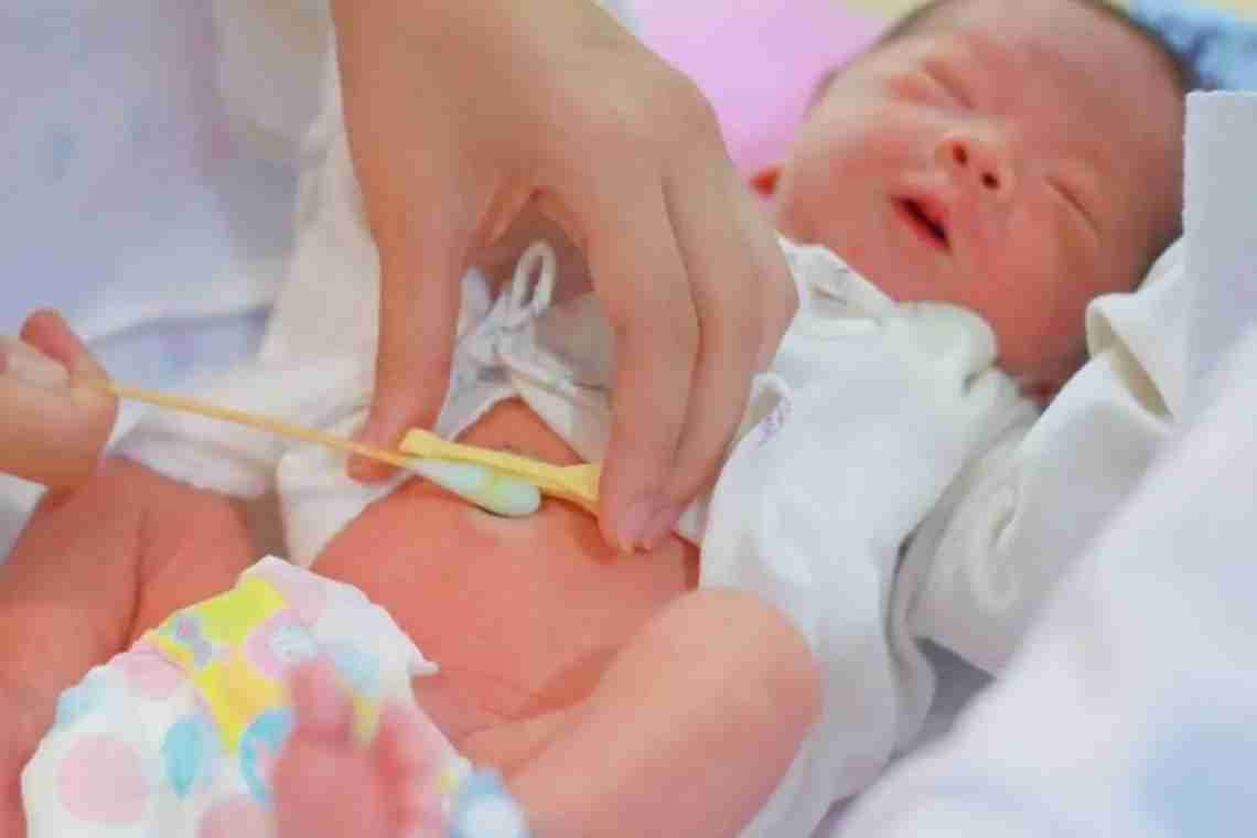 Как правильно делается обработка пупка у новорожденного