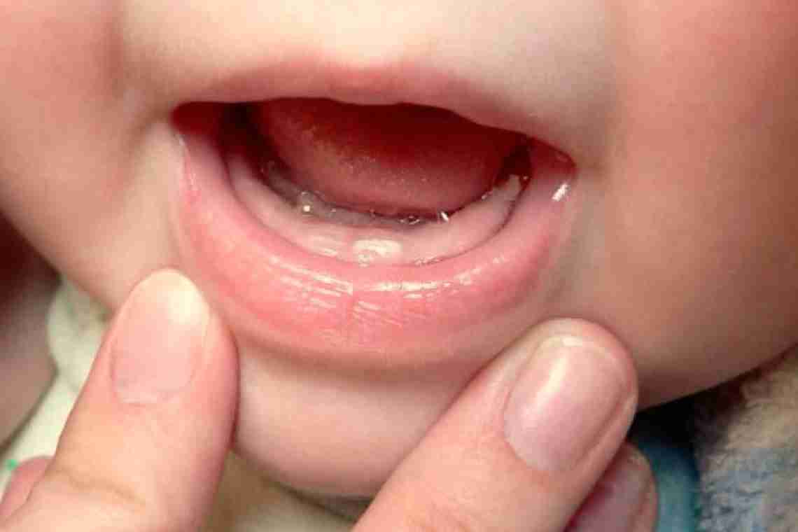 Первые зубки у ребенка: как это происходит?