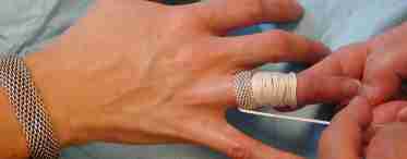 Несколько советов о том, как снять кольцо с отекшего пальца-страдальца