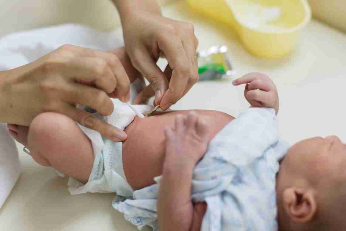 Обработка пупочной ранки новорожденного: что для этого необходимо и как проводится процедура