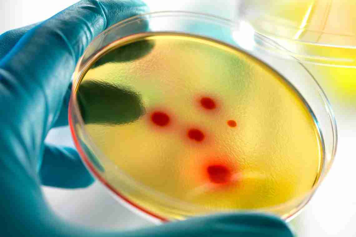 Бактерии в моче у ребенка: симптомы, причины, профилактика