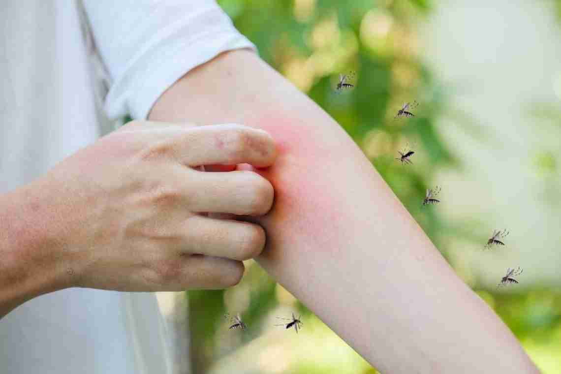 Почему комариные укусы чешутся?