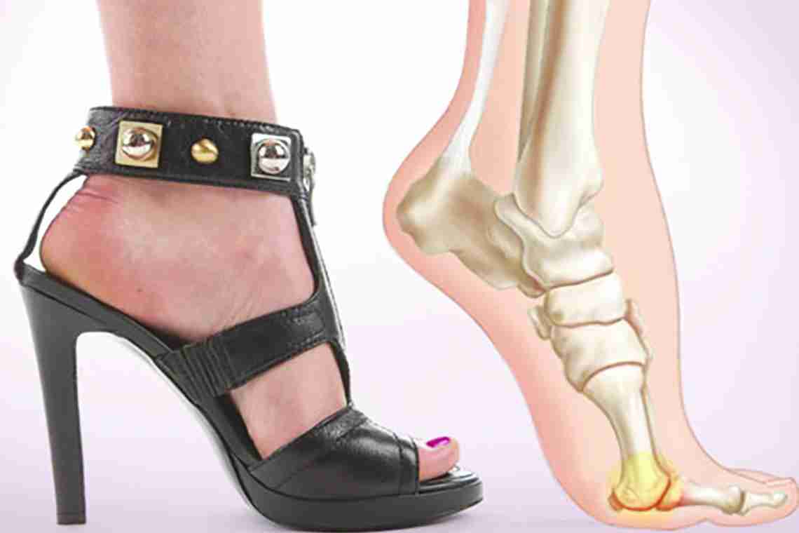Ортопедическая обувь для женщины: зачем ее носить?