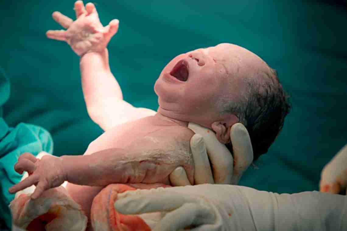 Как выглядит ребенок сразу после родов