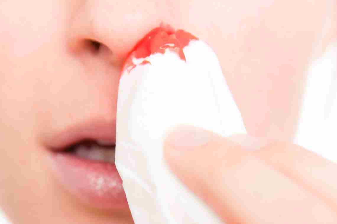 Почему течет кровь из носа при беременности