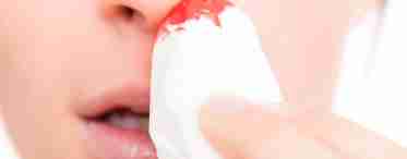 Почему течет кровь из носа при беременности