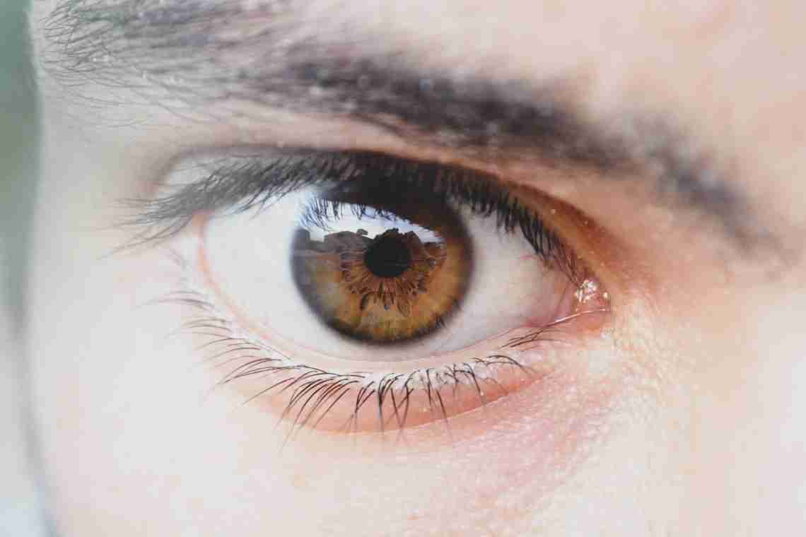 Капилляр в глазу лопнул: причины и лечение