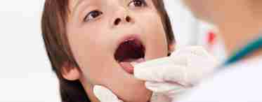 Инфекционное воспаление горла: лечение ангины у ребенка