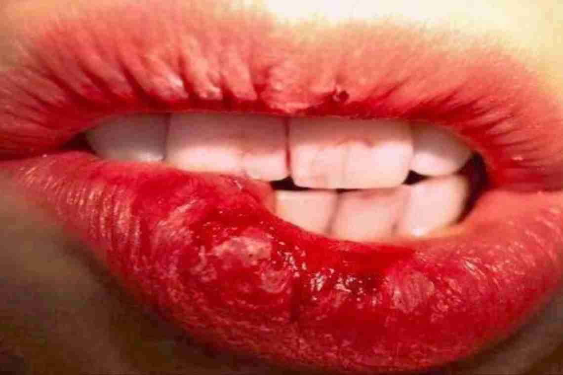 Почему появляется привкус крови во рту?