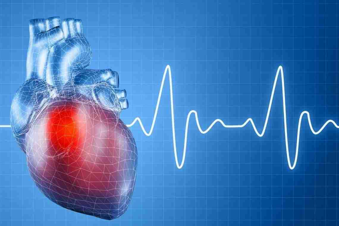 Аритмия сердца: лечение данной патологии
