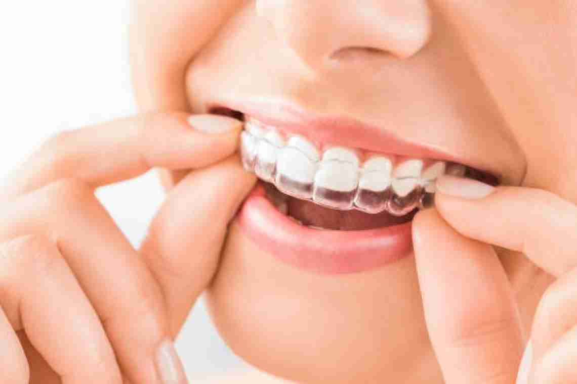 Ортодонтичні матеріали: основа сучасної ортодонтії